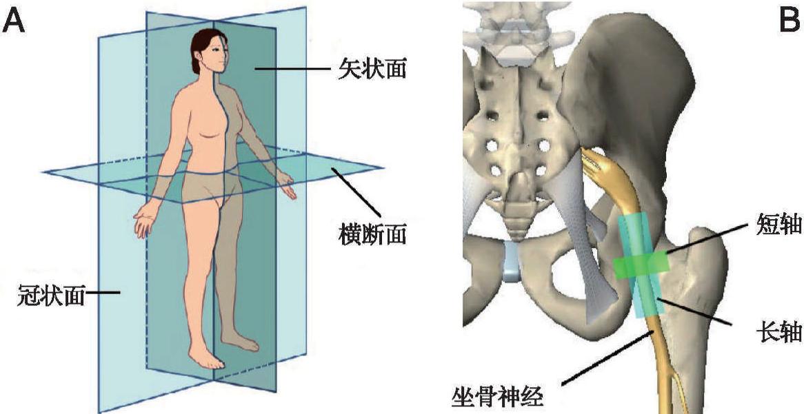 一、超声引导神经阻滞的相关术语